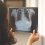 Quality Imaging in Radiography