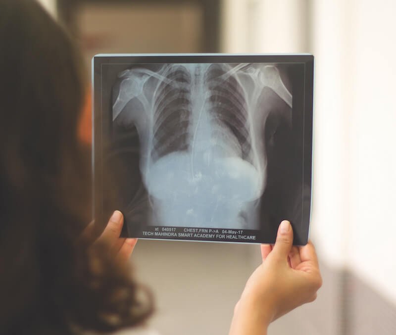 Quality Imaging in Radiography