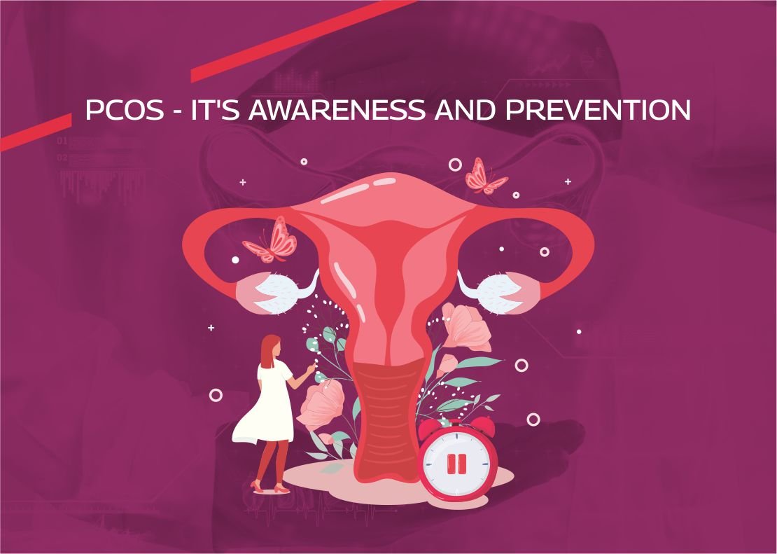 PCOS awareness and prevention: symptoms and management tips.